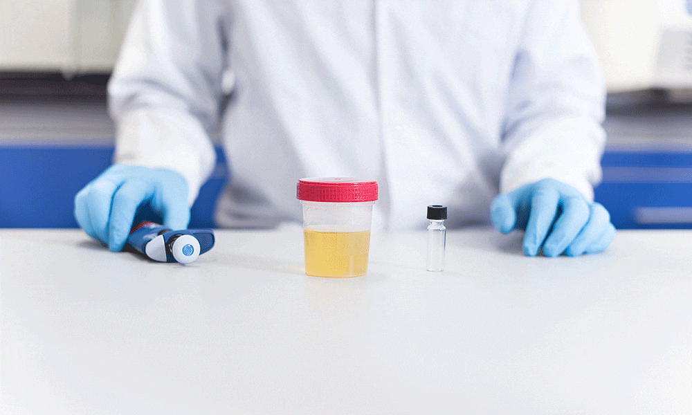 PCP urine test
